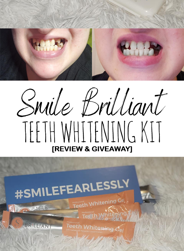 My Thoughts On Smile Brilliant’s Teeth Whitening Kit